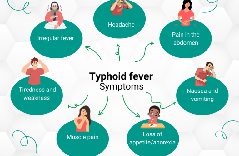 टाइफाइड: एक गंभीर बीमारी, जान ले इसके लक्षण, कारण और बचाव